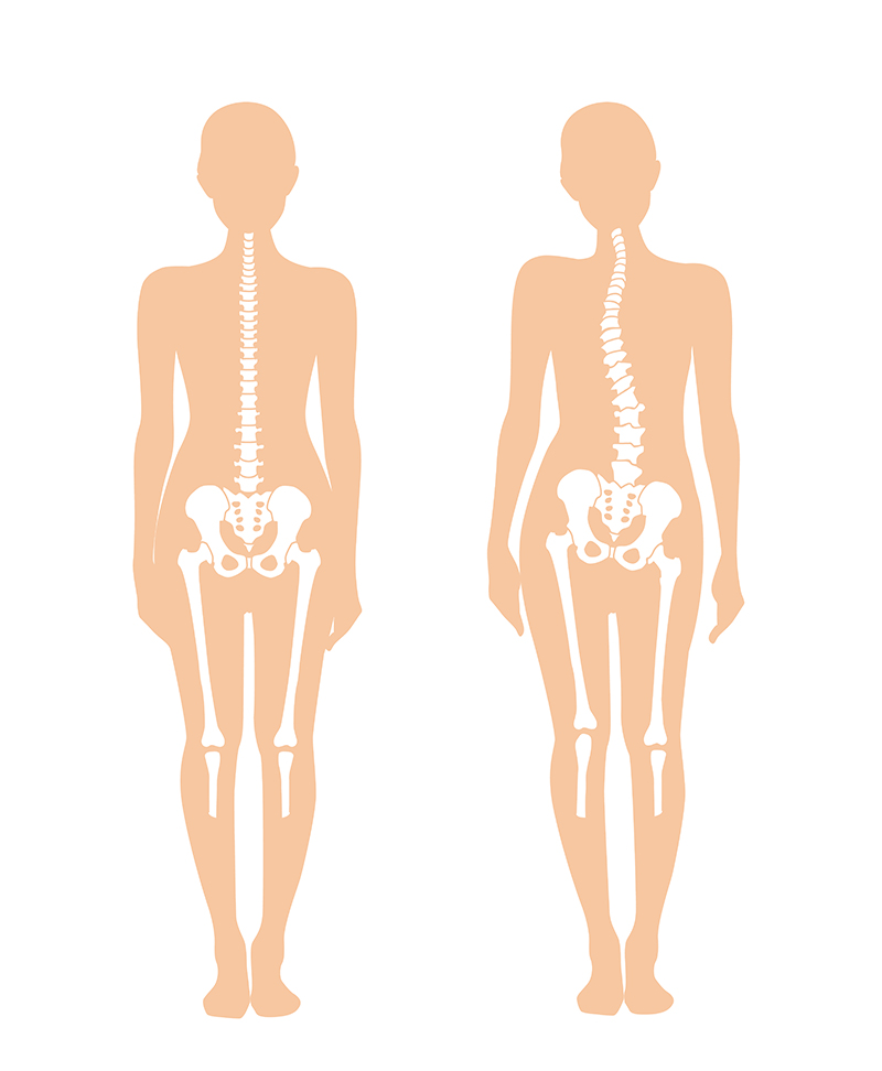 ①骨盤や腰椎など腰に関連する場所の働きが低下している