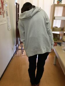 内臓疲労が原因のギックリ腰の女性
